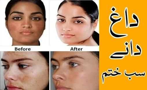 Rang gora karne ki tips in urdu screenshot 1