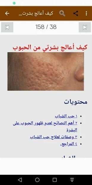 كيفية التخلص من حبوب البشرة
‎ screenshot 9
