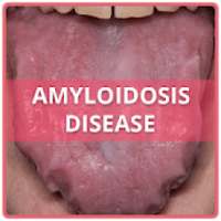 Amyloidosis Disease