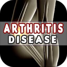 Arthritis: Causes, Diagnosis, and Treatment