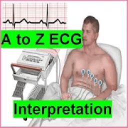 ikon A to Z ECG Interpretation