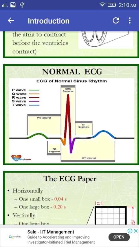 A to Z ECG Interpretation screenshot 6