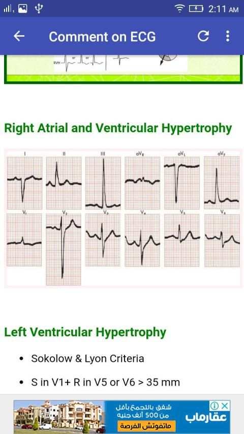A to Z ECG Interpretation screenshot 2