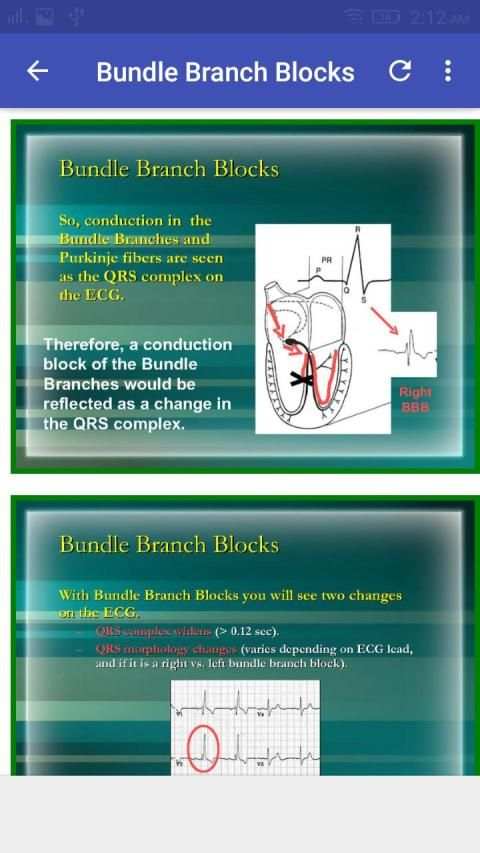 A to Z ECG Interpretation screenshot 1