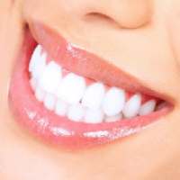 Natural Solutions for All types of Teeth problems on 9Apps