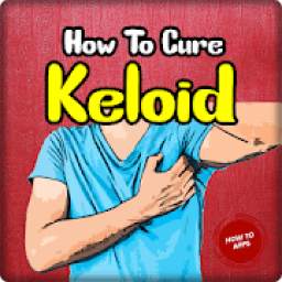How To Cure Keloid