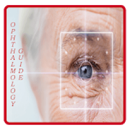 ikon Ophthalmology Guide