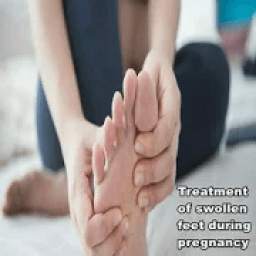 Treatment of foot swelling during pregnancy