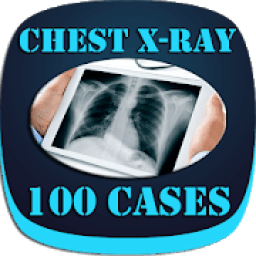 Interpret Chest X-Ray With 100 Cases आइकन