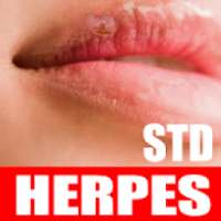 STD Herpes Treatment on 9Apps