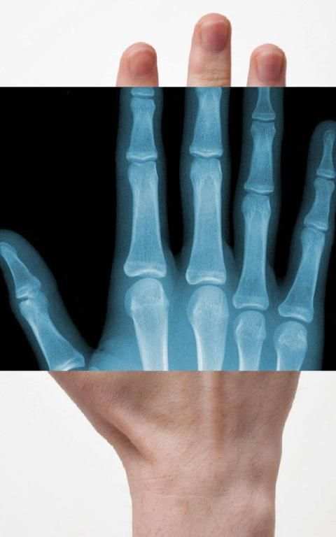 Xray Scanner screenshot 3