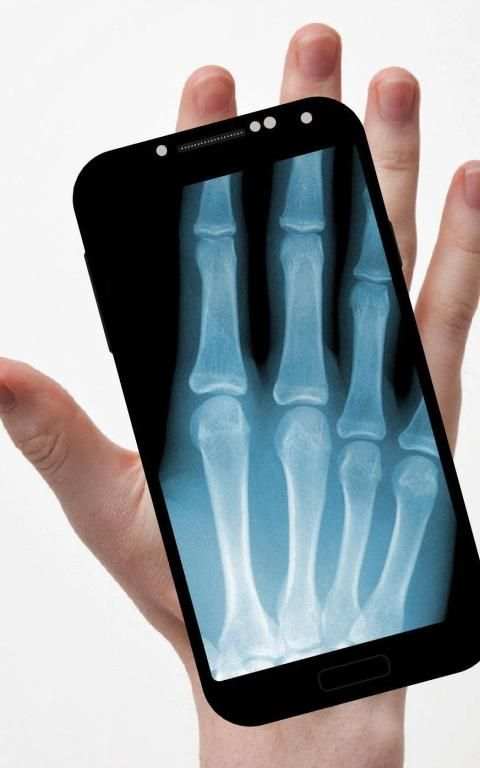 Xray Scanner screenshot 2