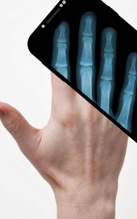 Xray Scanner screenshot 1