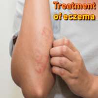 Home Remedies for Eczema on 9Apps