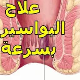 طريقة علاج البواسير بسرعة
‎