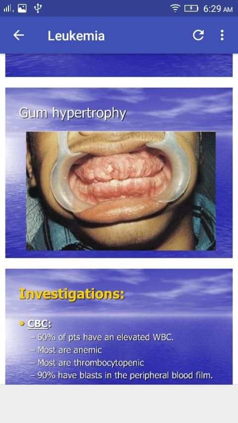 Hematology Overview screenshot 4