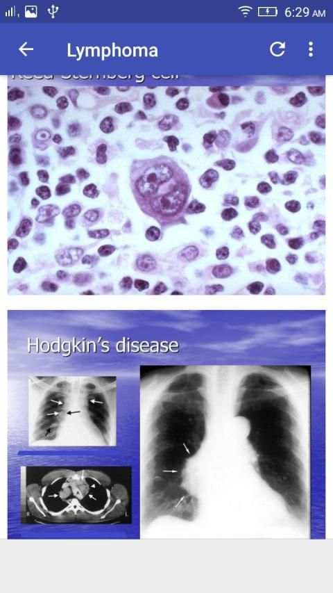 Hematology Overview screenshot 3