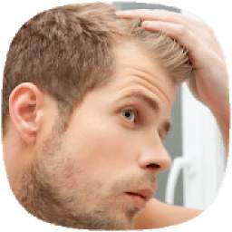 How to Stop Baldness Thinning Hair