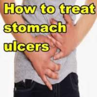 How to treat stomach ulcers on 9Apps