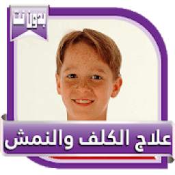 علاج الكلف والنمش
‎