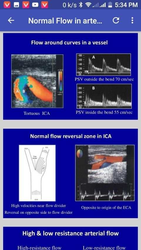 Doppler Ultrasound स्क्रीनशॉट 4