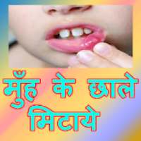 Mooh Se Chaale Door Karne Ke 71 Upay In Hindi