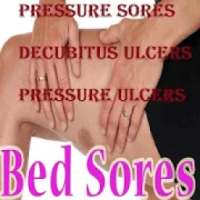 Bed Sores (Pressure Ulcer)