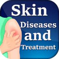 Fungal infection treatment-रोग और उपचार on 9Apps