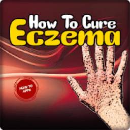 How To Cure Eczema