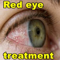 Red eye treatment