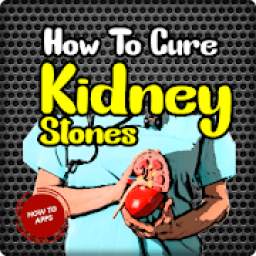 How To Cure Kidney Stones