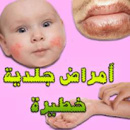 عندما يحذرك الجلد..أعراض تظهر على بشرتك تدل على أمراض خطيرة 1.0