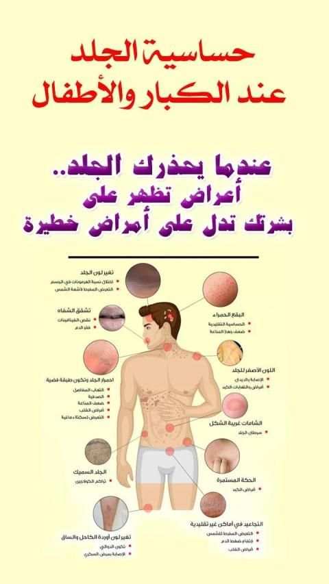 عندما يحذرك الجلد..علامات تدل على أمراض خطيرة
‎ скриншот 9