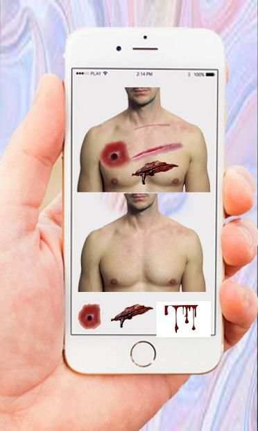 Injury Photo Editor-Fake Injury Photo Editor 2019 screenshot 2