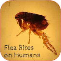 Signs of Flea Bites.