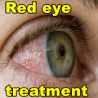 Red eye treatment on 9Apps