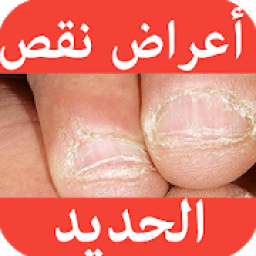 أعراض نقص الحديد في جسم الإنسان
‎ icon