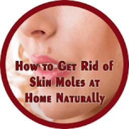 How to Get Rid of Skin Moles at Home Naturally