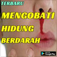 Terbaru Ramuan Herbal Mengatasi Hidung Berdarah on 9Apps