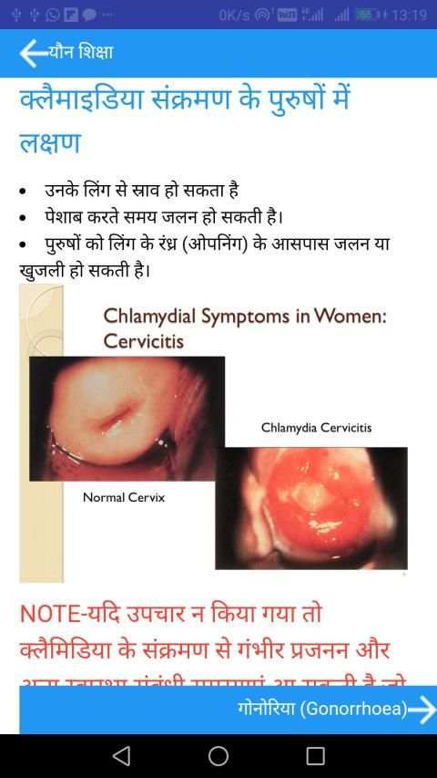 Sex Education in Hindi screenshot 6