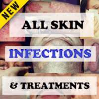 All Skin Infections & Treatments - Diseases Atlas on 9Apps