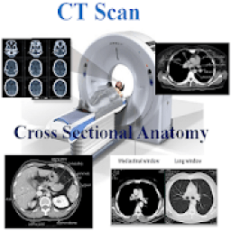 ikon CT Scan Cross Sectional Anatomy