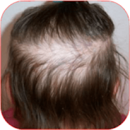 Hair Growth in Children आइकन