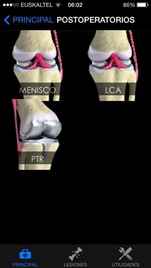 Rodilla Ap स्क्रीनशॉट 3