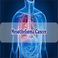 mesothelioma cancer best info mesothelioma cancer on 9Apps