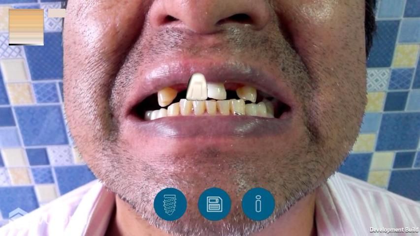 ImplantAR screenshot 4