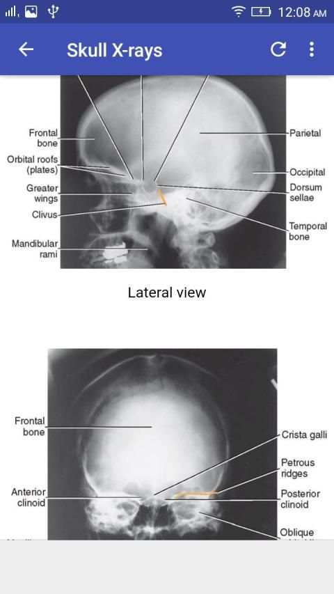 X-Ray Interpretation screenshot 13