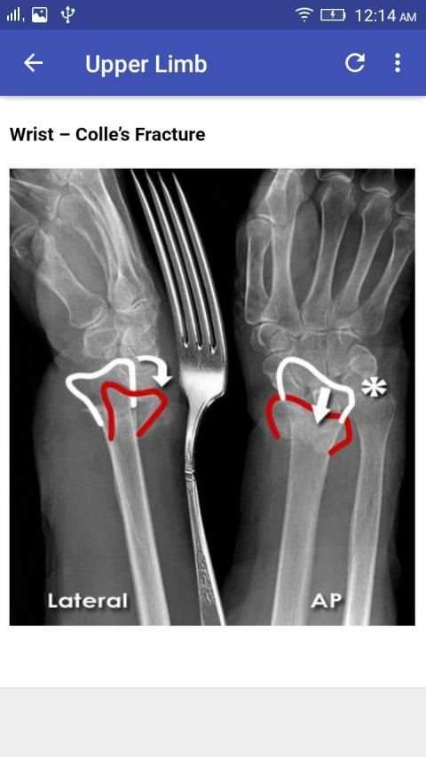 X-Ray Interpretation screenshot 2