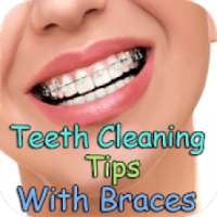 Teeth Cleaning Tips With Braces