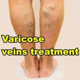 Varicose veins treatment icon